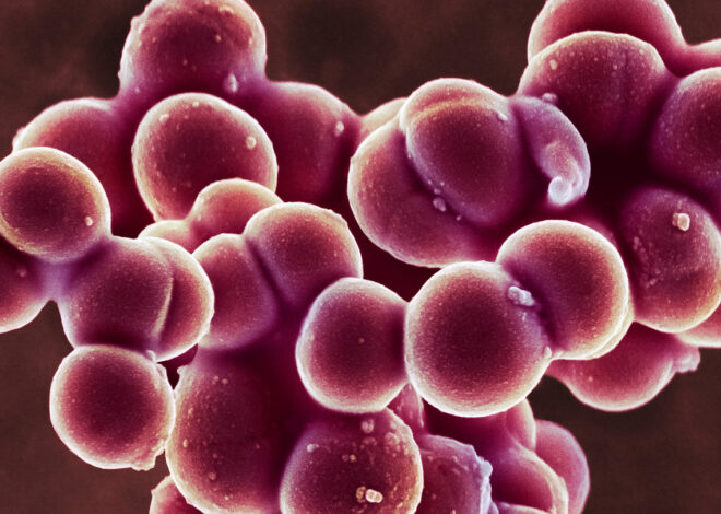 Staphylococcus Bacteria Exhibit Strong Adhesion Properties, Impeding Detachment