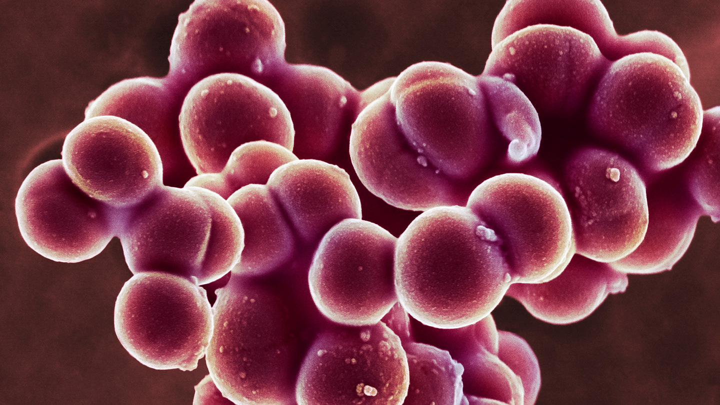 Staphylococcus Bacteria Exhibit Strong Adhesion Properties, Impeding Detachment