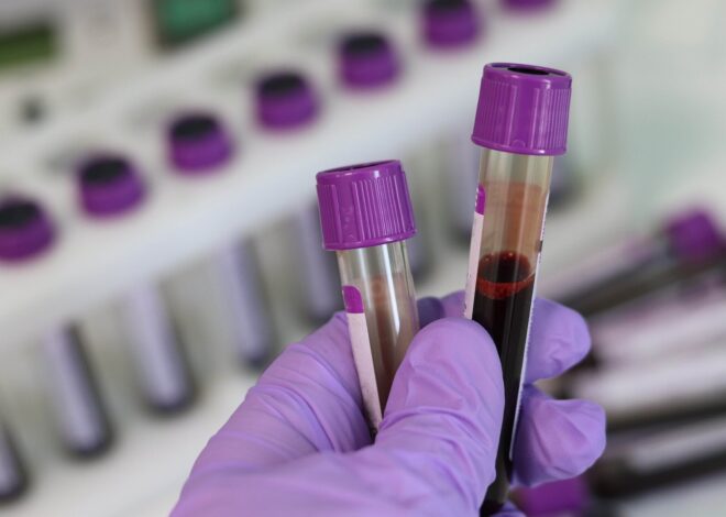 Blood test identifies HPV-associated head and neck cancers up to 10 years before symptoms