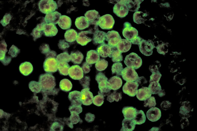 Alarm in India’s Kerala as cases of ‘brain-eating’ amoeba rise | Health News | Al Jazeera