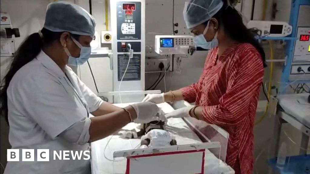 Uttar Pradesh: Newborn baby buried alive in India fights for her life