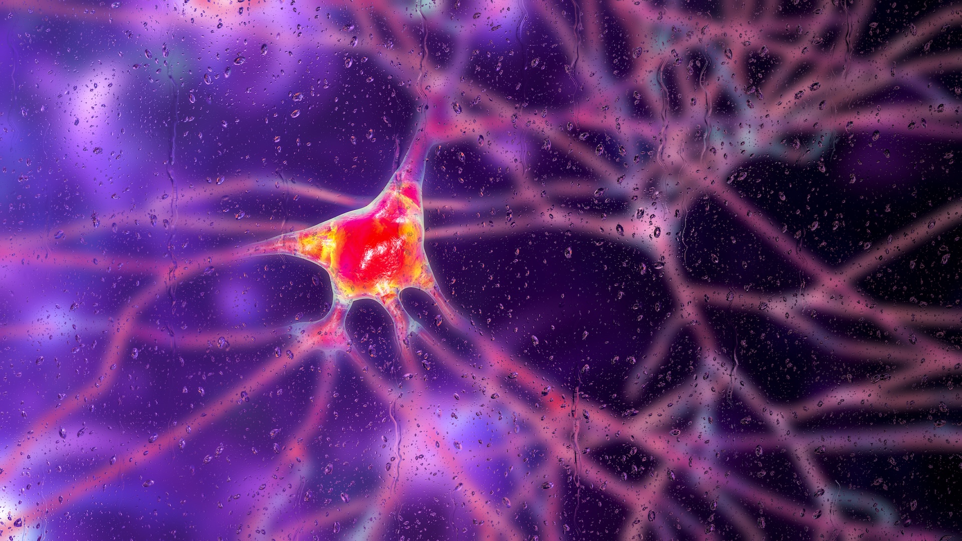 Revolutionary Gene Therapy: First Treatment to Slow Huntington’s Disease Progression