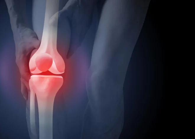 The surprising reason x-rays can push arthritis patients toward surgery
