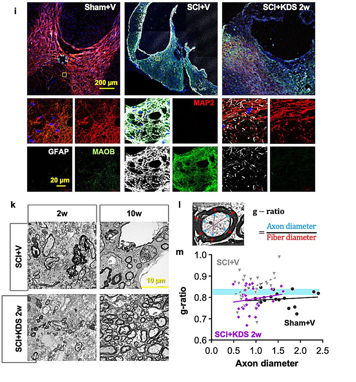 Inhibiting an astrocytic ‘brake’ that blocks spinal cord repair could pave path to neuronal regeneration