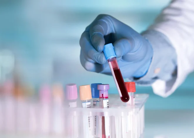 Simple blood test could spot Alzheimer’s years before symptoms