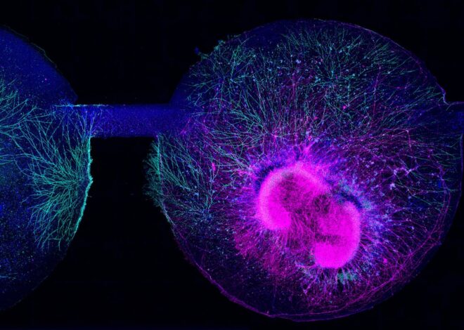 NIH Allocates Funding for Autism Research: Exploring Gene-Environment Interactions Amid Trump’s Tylenol Debate