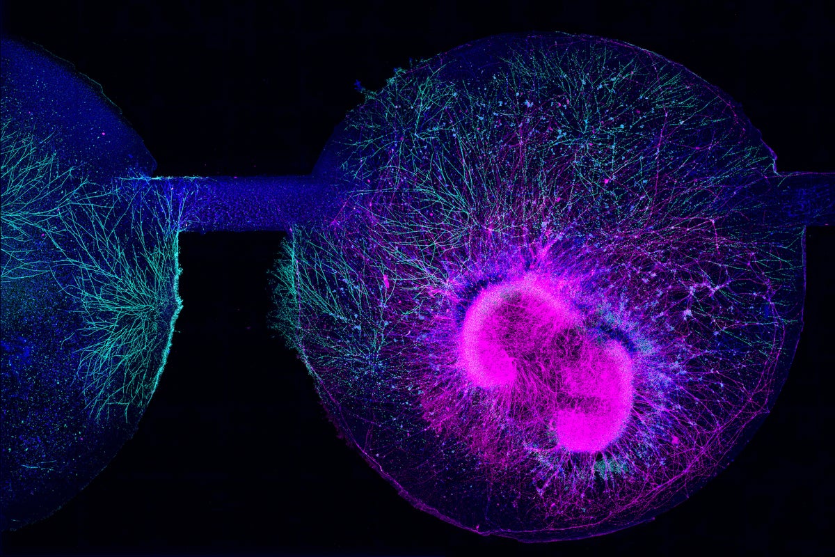 NIH Allocates Funding for Autism Research: Exploring Gene-Environment Interactions Amid Trump’s Tylenol Debate