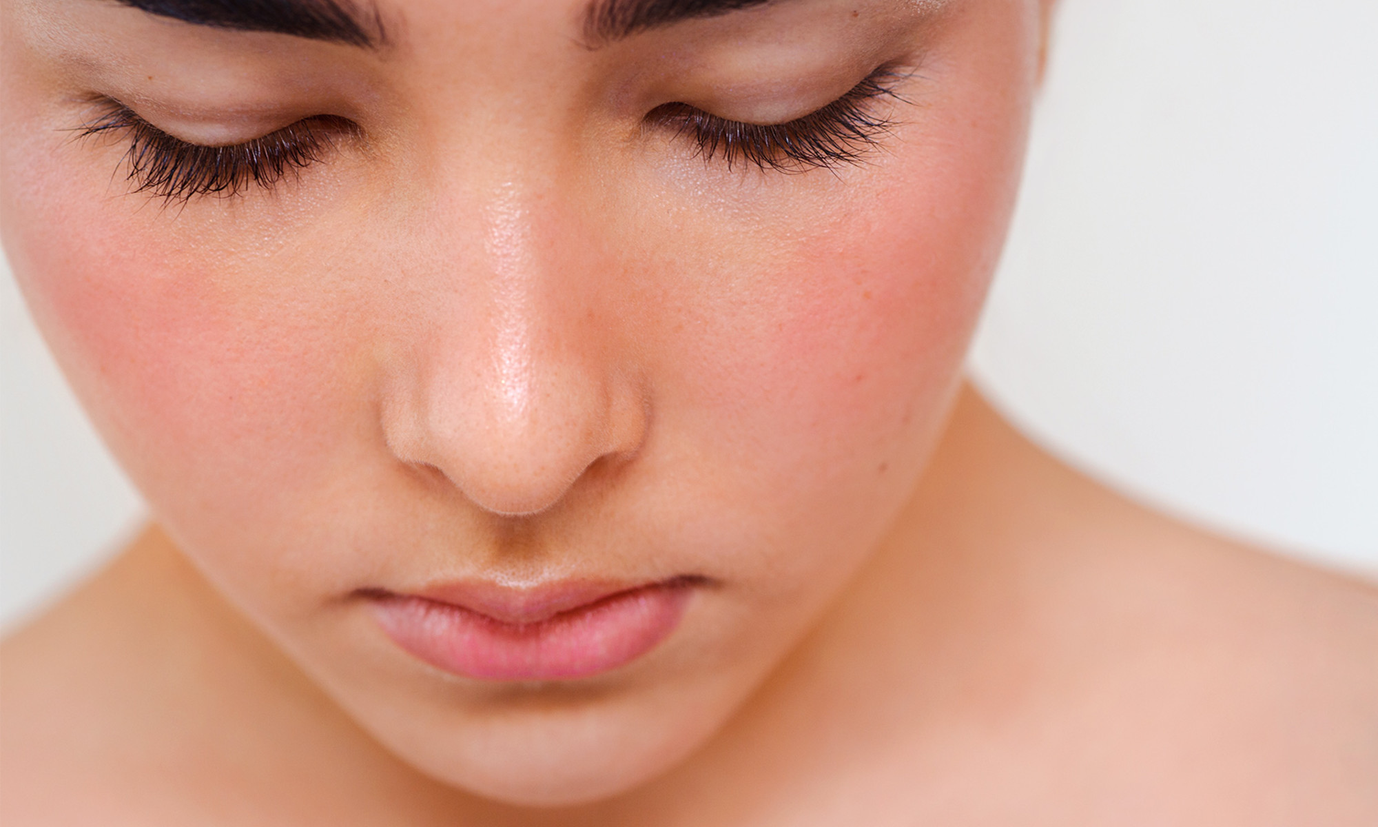 Unlocking the Gut-Rosacea Connection: Insights from an Integrative Dermatologist