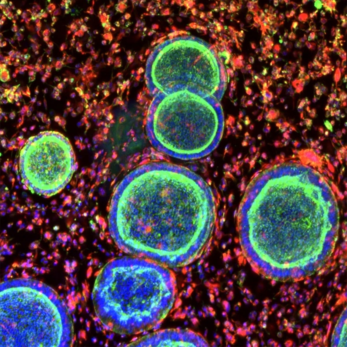 Revolutionary Lab-Grown Organoids Have the Potential to Transform Women’s Reproductive Medicine