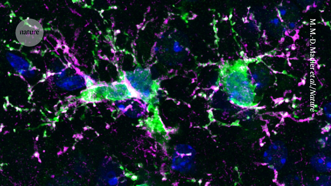 Replacing Aging Immune Cells in the Brain with New Ones May Offer Disease Treatment
