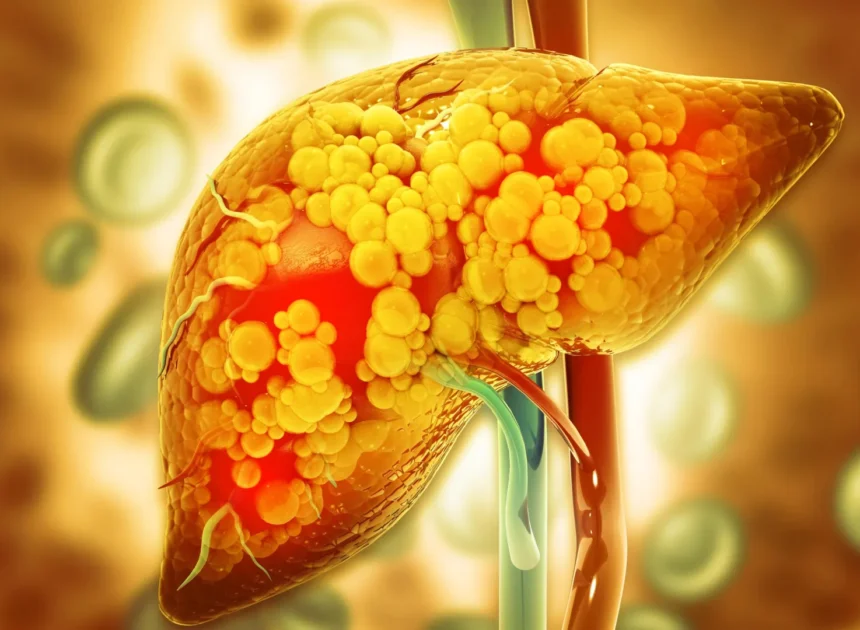 Scientists finally reveal the hidden mechanism linking alcohol to fatty liver