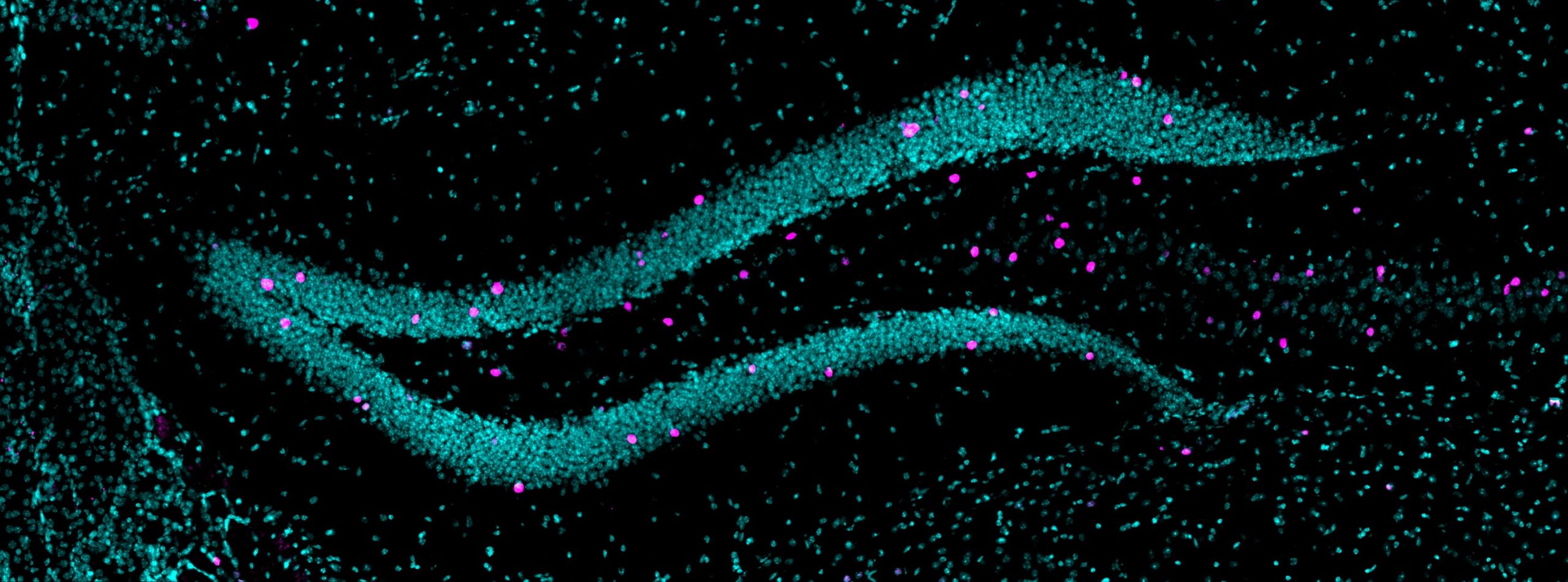 Inflammation during pregnancy may prime offspring for anxiety