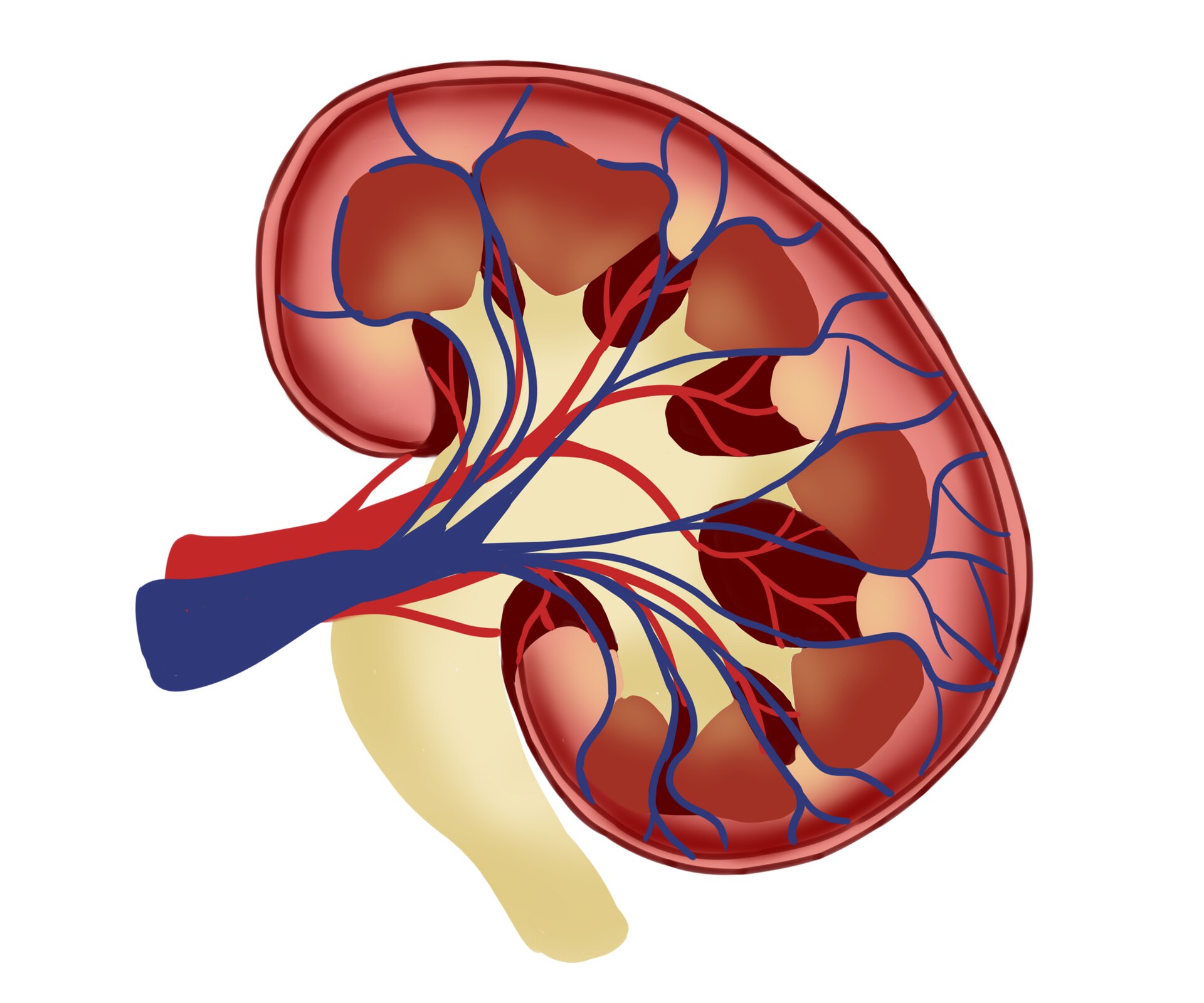New medication lowers hard-to-control high blood pressure in people with chronic kidney disease
