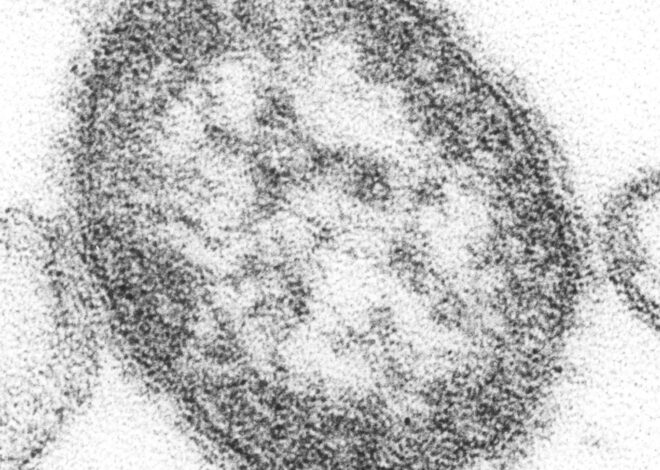 Child dies from complication of measles contracted years earlier
