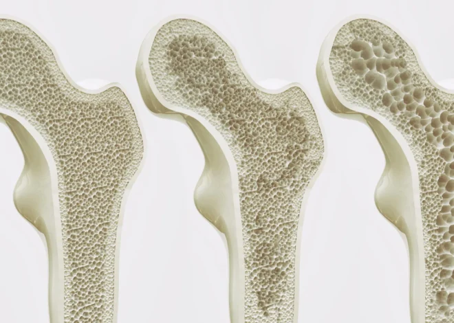 Scientists may have found a way to strengthen bones for life