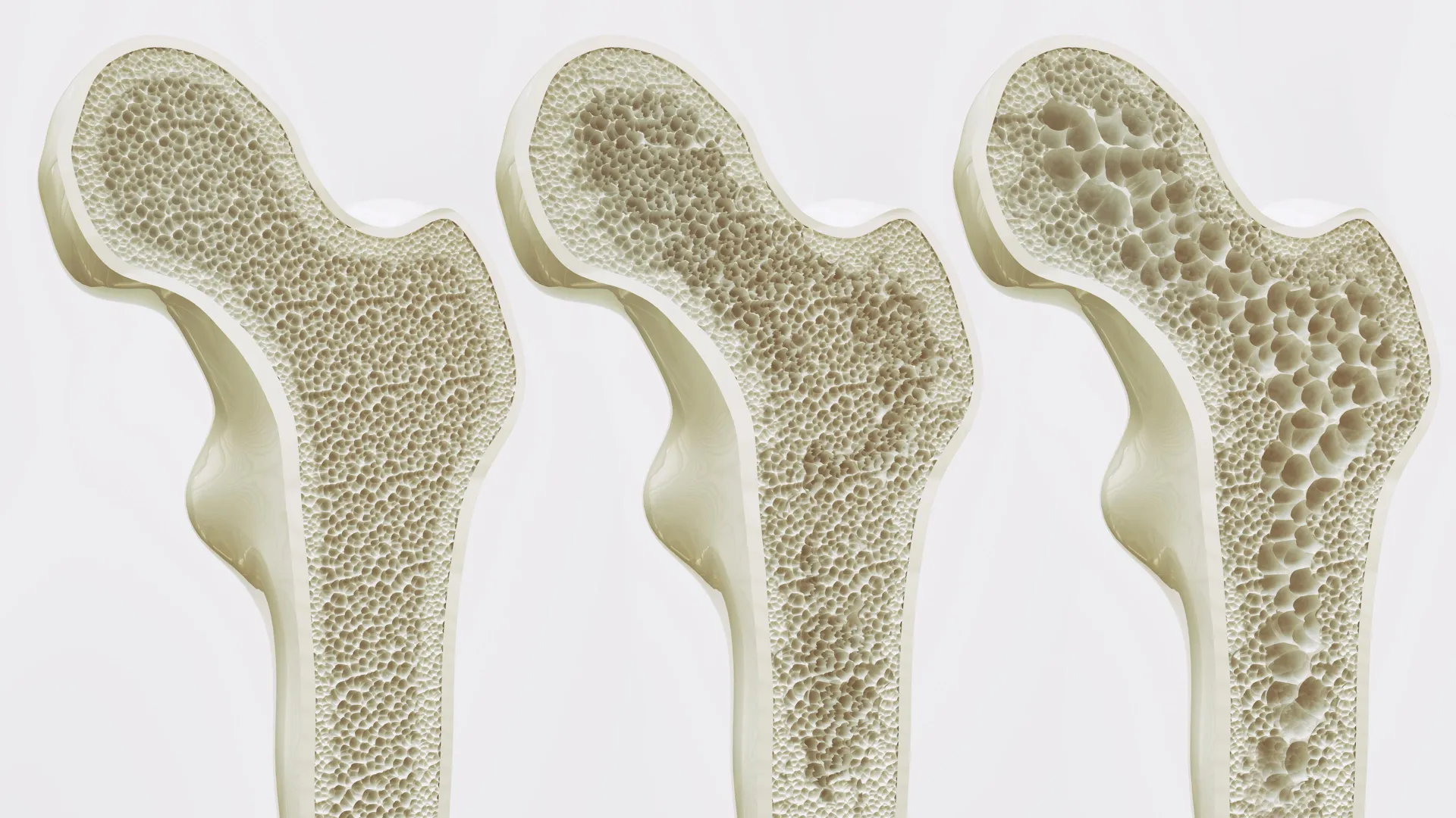 Scientists may have found a way to strengthen bones for life
