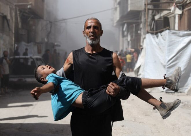 Foreign doctors say Israel systematically targeting Gaza’s children: Report | Israel-Palestine conflict News | Al Jazeera